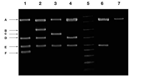 interpretation of dna gel electrophoresis results|Part 2: Analysing and Interpreting (Agarose) Gel Electrophoresis .